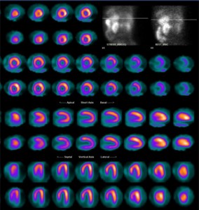 Nuclear Medicine