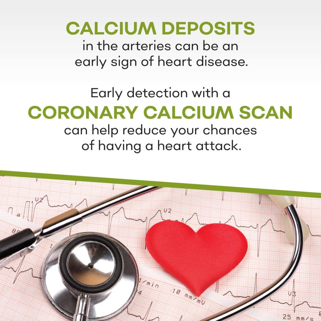Should I Consider a Coronary Calcium Scan?