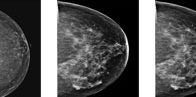 breast-image1